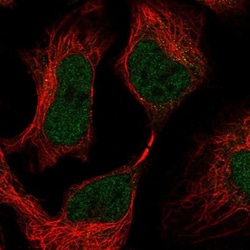 SKIV2L Antibody, Novus Biologicals 0.1mL; Unlabeled:Antibodies, Polyclonal
